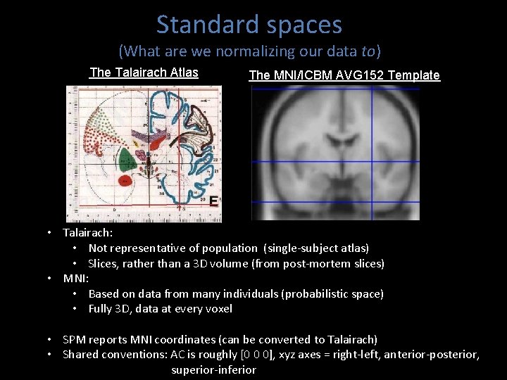 Standard spaces (What are we normalizing our data to) The Talairach Atlas The MNI/ICBM Standard spaces (What are we normalizing our data to) The Talairach Atlas The MNI/ICBM
