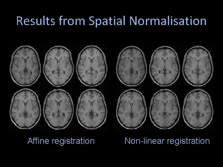 Results from Spatial Normalisation Affine registration Non-linear registration Results from Spatial Normalisation Affine registration Non-linear registration