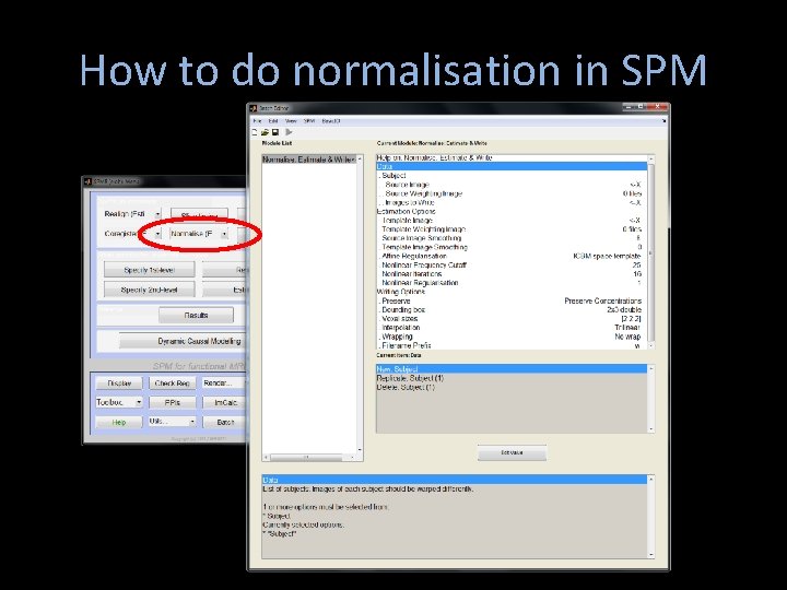 How to do normalisation in SPM How to do normalisation in SPM