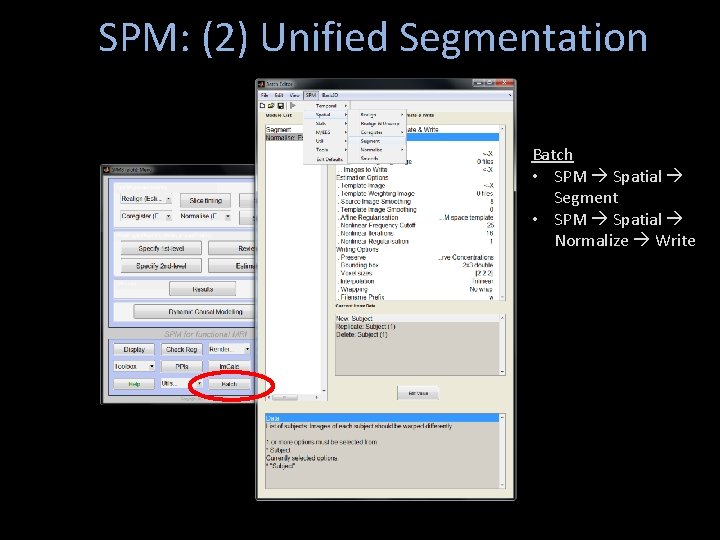 SPM: (2) Unified Segmentation Batch • SPM Spatial Segment • SPM Spatial Normalize Write SPM: (2) Unified Segmentation Batch • SPM Spatial Segment • SPM Spatial Normalize Write