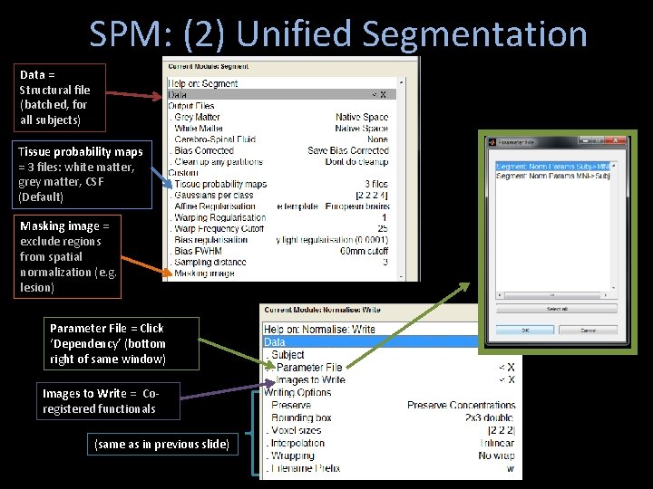 SPM: (2) Unified Segmentation Data = Structural file (batched, for all subjects) Tissue probability SPM: (2) Unified Segmentation Data = Structural file (batched, for all subjects) Tissue probability