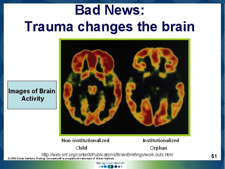 Bad News: Trauma changes the brain Images of Brain Activity Non-institutionalized Child Institutionalized Orphan