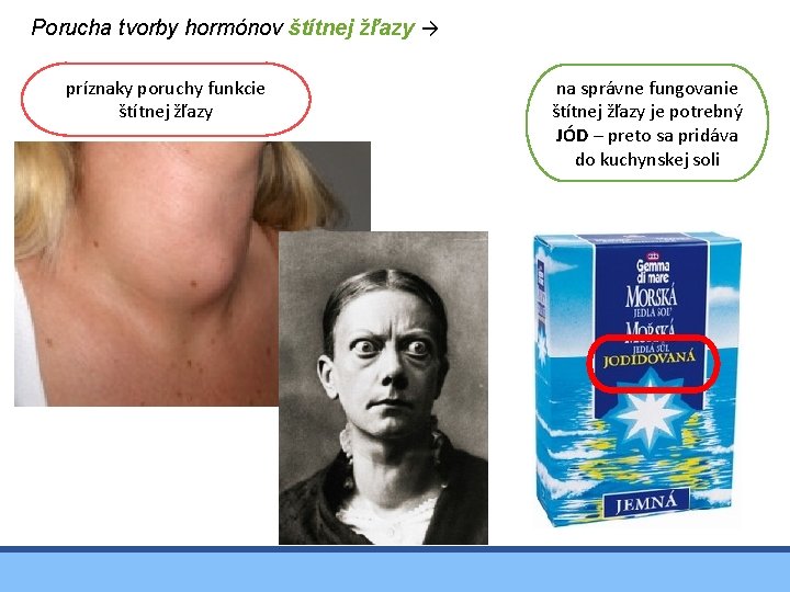 Porucha tvorby hormónov štítnej žľazy → príznaky poruchy funkcie štítnej žľazy na správne fungovanie