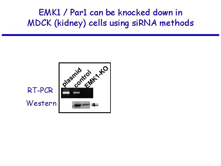 EMK 1 / Par 1 can be knocked down in MDCK (kidney) cells using