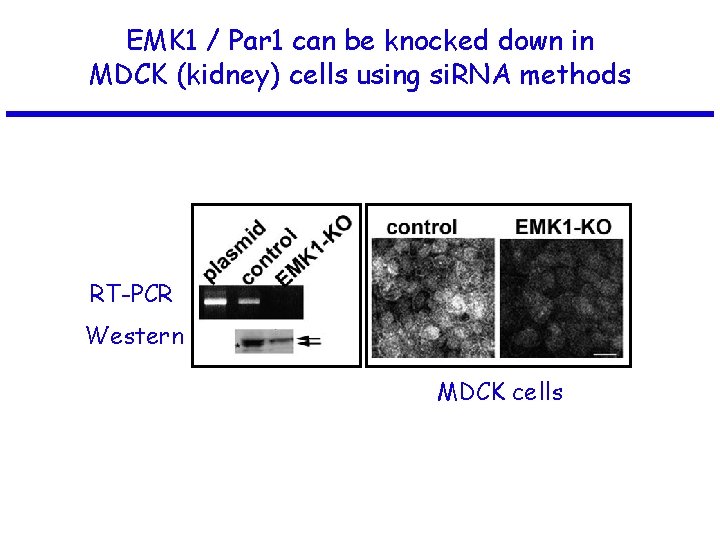 EMK 1 / Par 1 can be knocked down in MDCK (kidney) cells using
