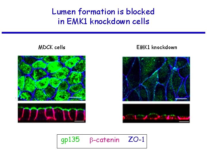Lumen formation is blocked in EMK 1 knockdown cells MDCK cells gp 135 EMK