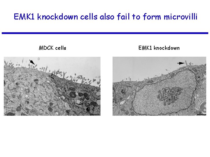 EMK 1 knockdown cells also fail to form microvilli MDCK cells EMK 1 knockdown