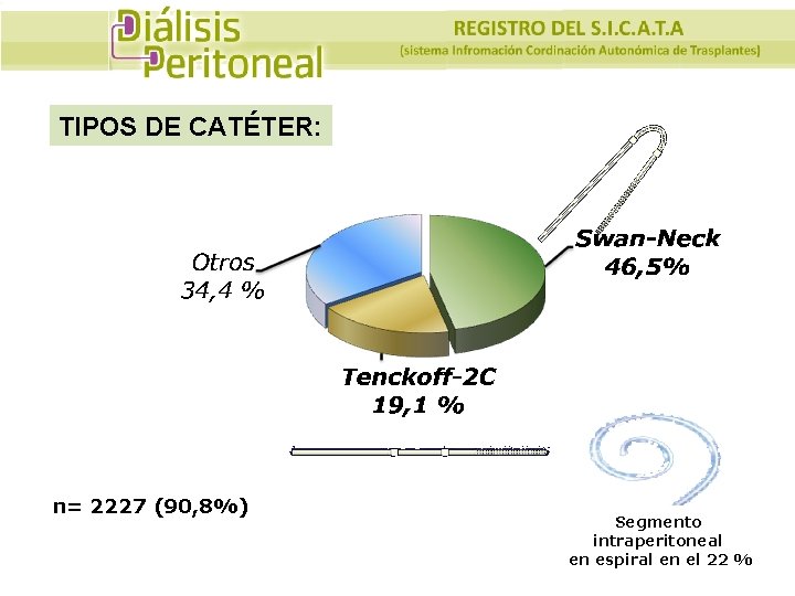 TIPOS DE CATÉTER: n= 2227 (90, 8%) Segmento intraperitoneal en espiral en el 22