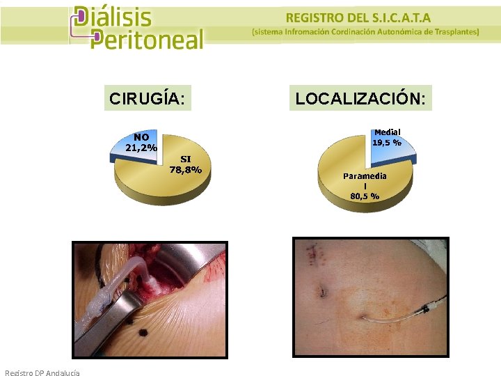 CIRUGÍA: Registro DP Andalucía LOCALIZACIÓN: 