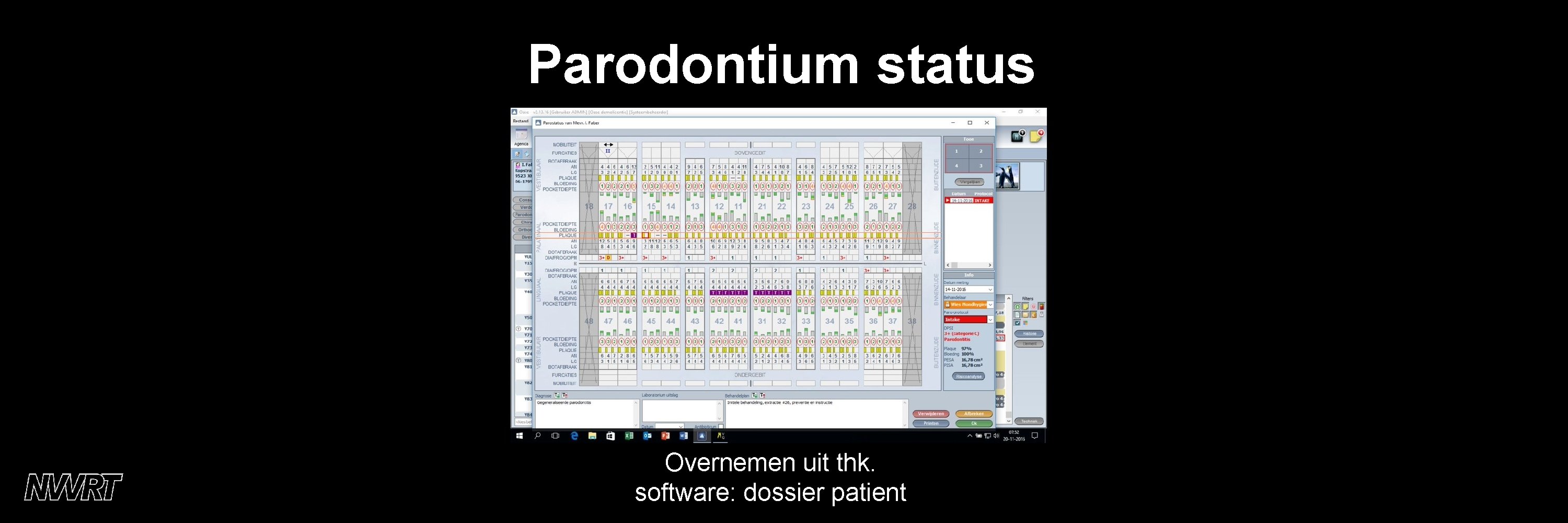 Parodontium status Overnemen uit thk. software: dossier patient 