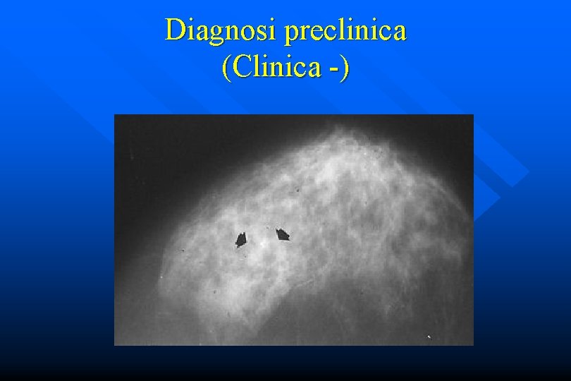 Diagnosi preclinica (Clinica -) 