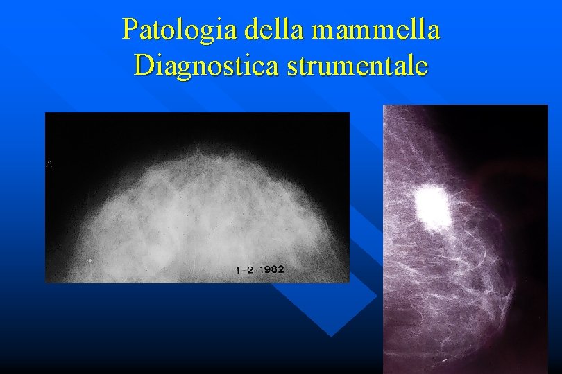 Patologia della mammella Diagnostica strumentale 