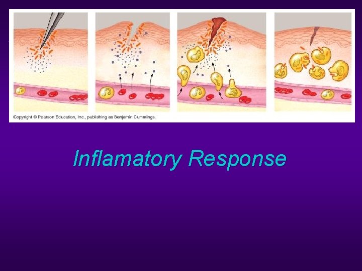 Inflamatory Response 