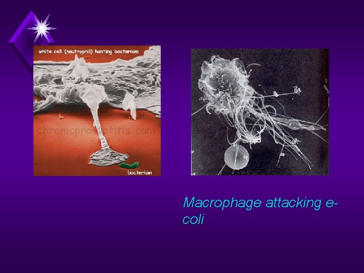 Macrophage attacking ecoli 