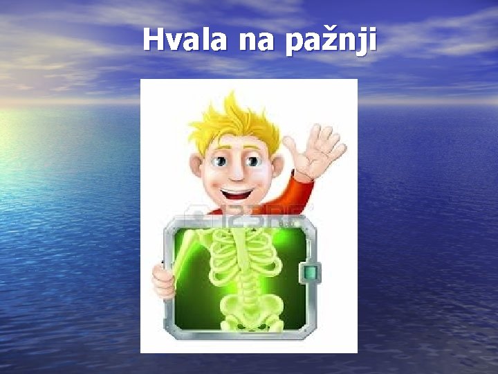 Hvala na pažnji 