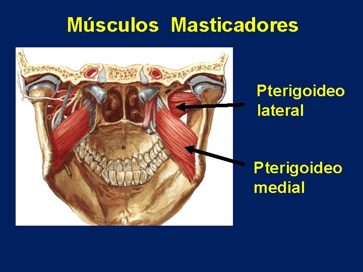 Músculos Masticadores Pterigoideo lateral Pterigoideo medial 