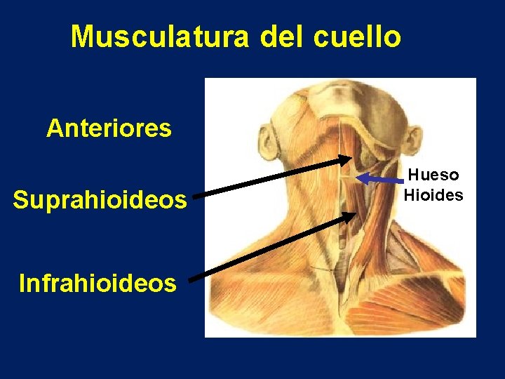 Musculatura del cuello Anteriores Suprahioideos Infrahioideos Hueso Hioides 