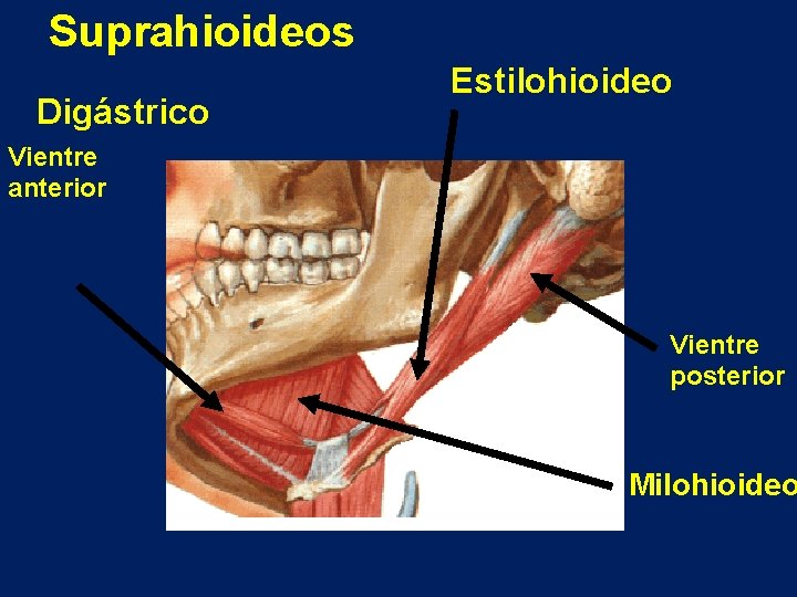 Suprahioideos Digástrico Estilohioideo Vientre anterior Vientre posterior Milohioideo 