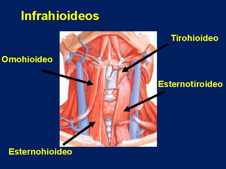 Infrahioideos Tirohioideo Omohioideo Esternotiroideo Esternohioideo 