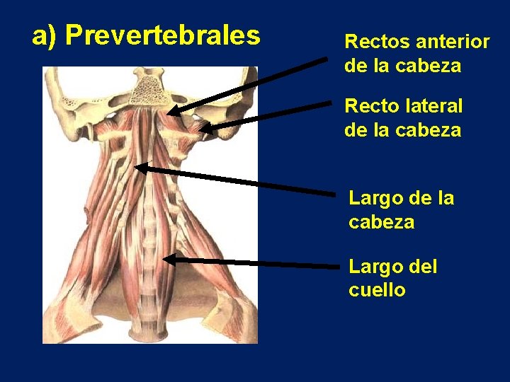 a) Prevertebrales Rectos anterior de la cabeza Recto lateral de la cabeza Largo del