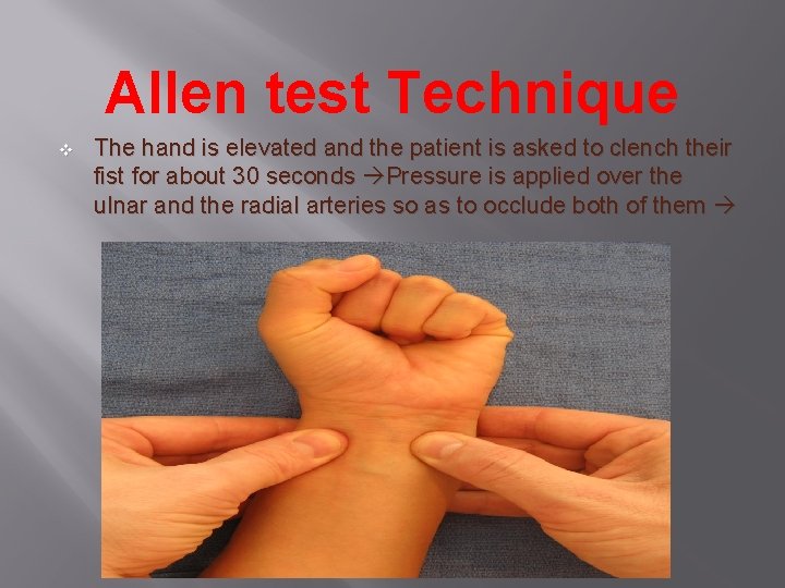 Allen test Technique v The hand is elevated and the patient is asked to