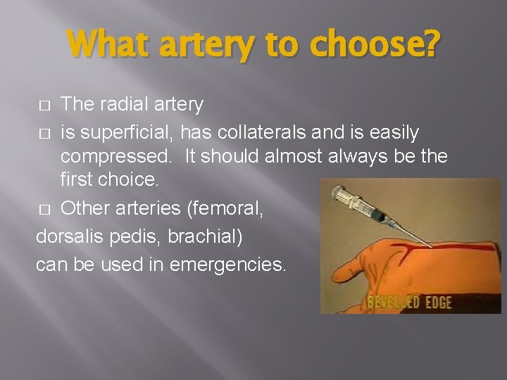 What artery to choose? The radial artery � is superficial, has collaterals and is