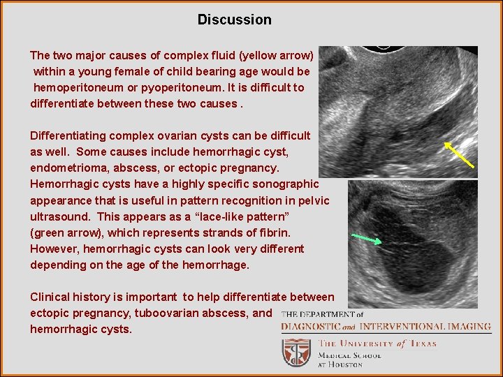 Discussion The two major causes of complex fluid (yellow arrow) within a young female