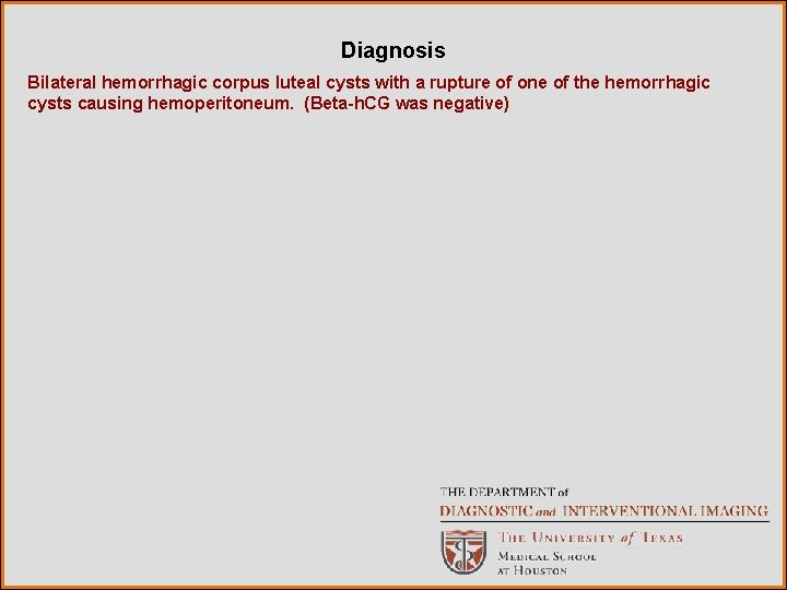 Diagnosis Bilateral hemorrhagic corpus luteal cysts with a rupture of one of the hemorrhagic