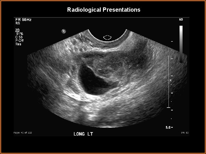 Radiological Presentations 