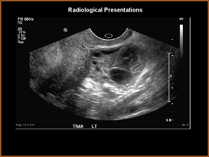 Radiological Presentations 