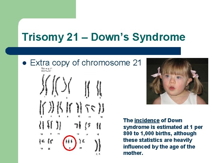 Trisomy 21 – Down’s Syndrome l Extra copy of chromosome 21 The incidence of