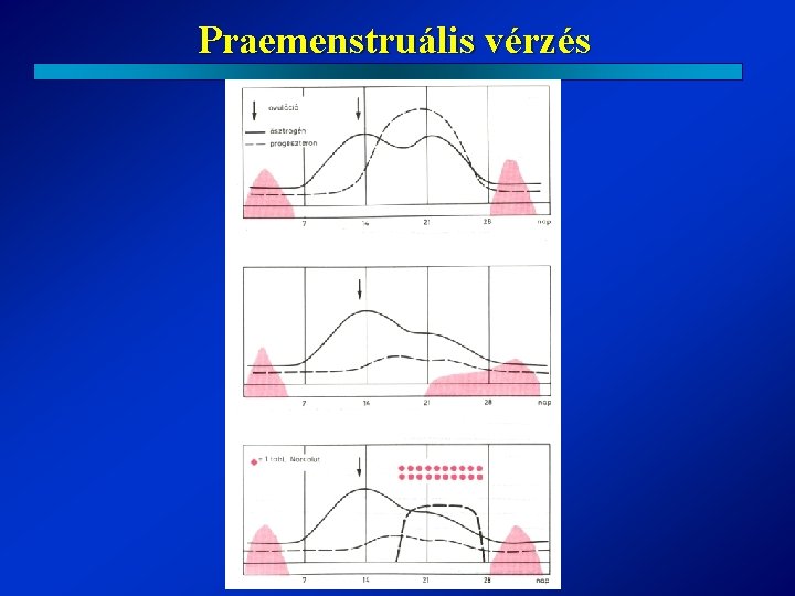 Praemenstruális vérzés 