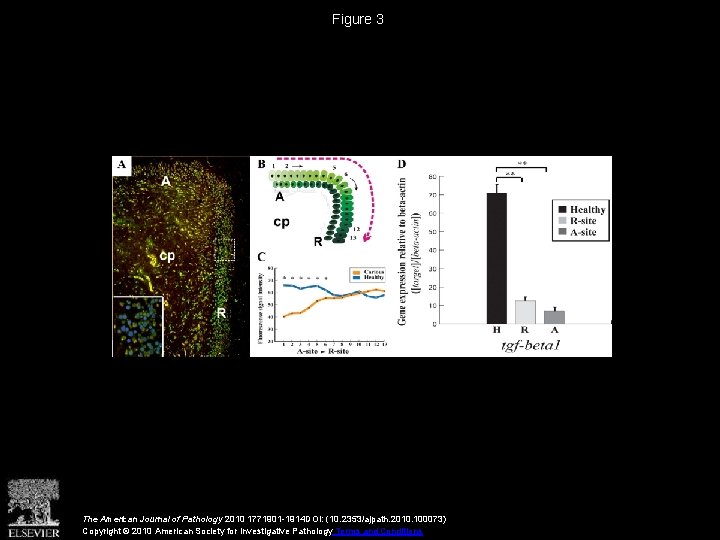 Figure 3 The American Journal of Pathology 2010 1771901 -1914 DOI: (10. 2353/ajpath. 2010.