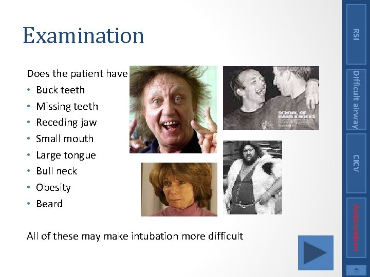 CICV Anticipation All of these may make intubation more difficult Difficult airway Does the
