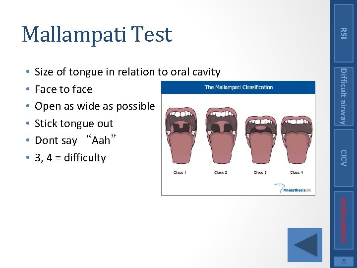 CICV Size of tongue in relation to oral cavity Face to face Open as