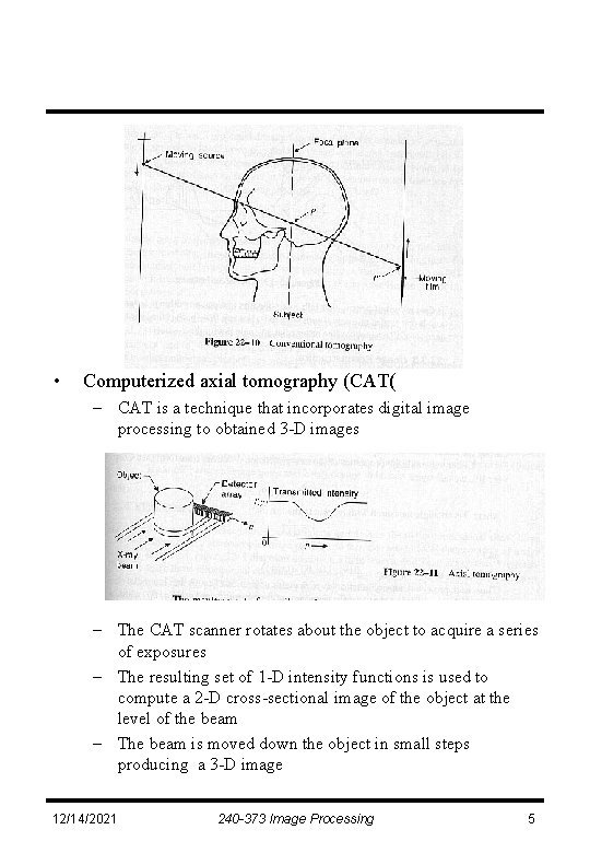  • Computerized axial tomography (CAT( – CAT is a technique that incorporates digital