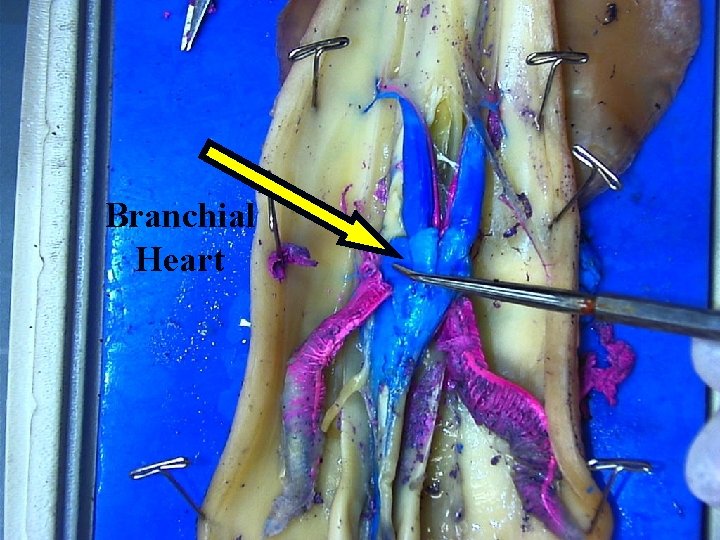 Branchial Heart 