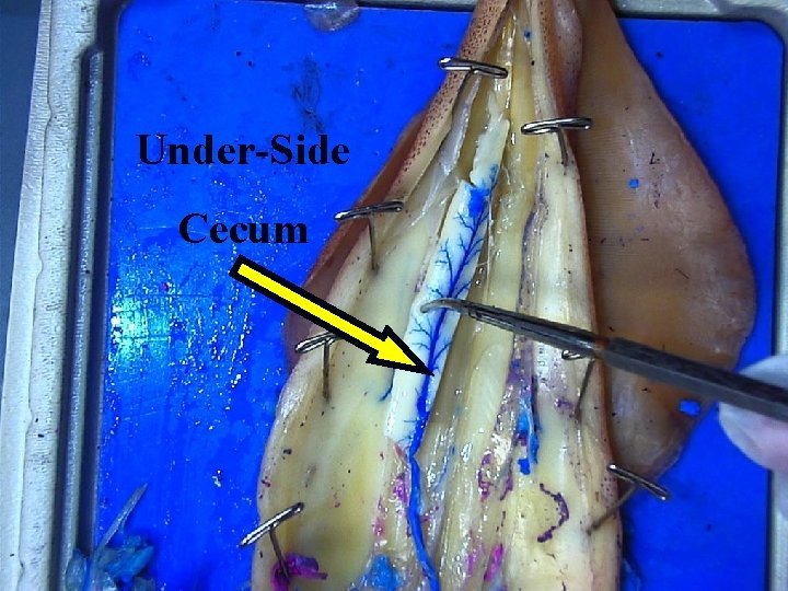 Under-Side Cecum 