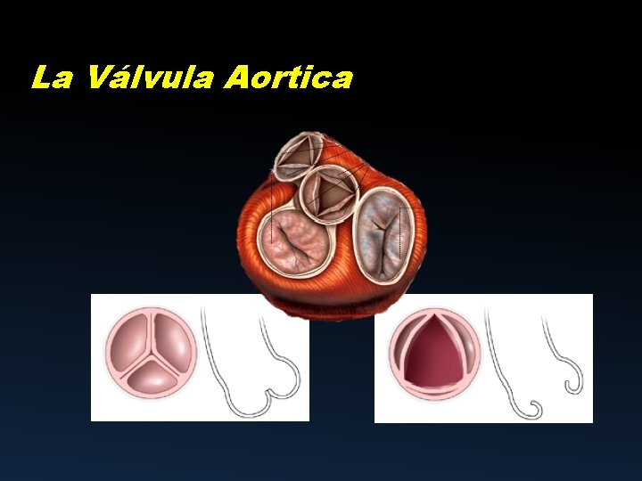 La Válvula Aortica 