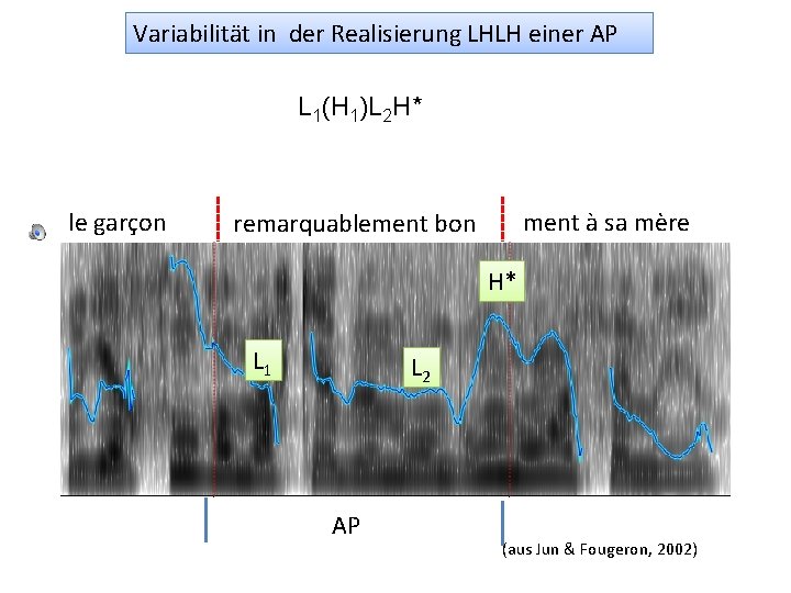 Variabilität in der Realisierung LHLH einer AP L 1(H 1)L 2 H* le garçon