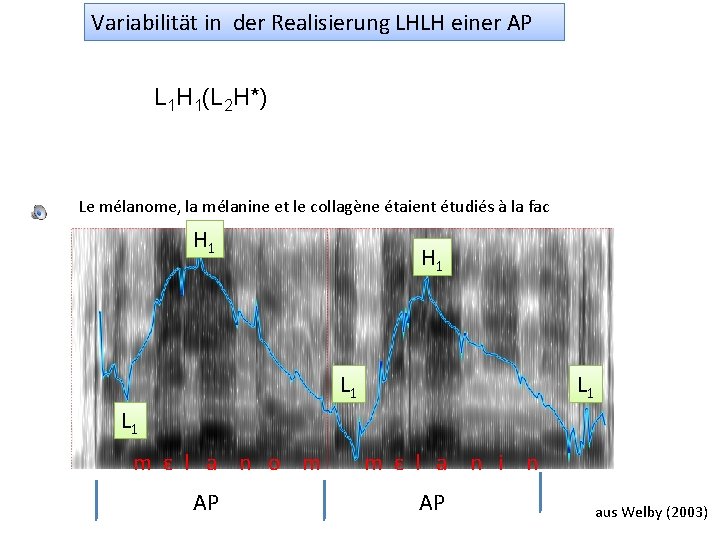 Variabilität in der Realisierung LHLH einer AP L 1 H 1(L 2 H*) Le