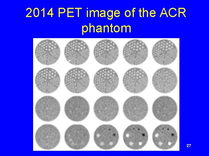 2014 PET image of the ACR phantom 7. 9 mm 27 