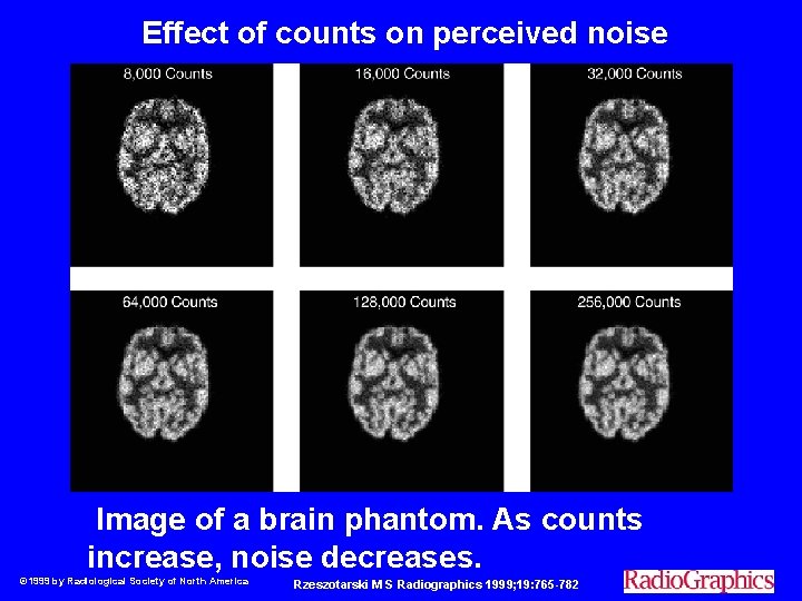Effect of counts on perceived noise Image of a brain phantom. As counts increase,