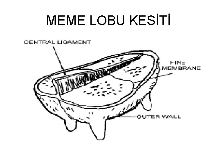 MEME LOBU KESİTİ 