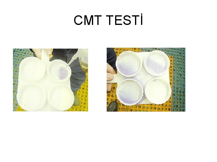 CMT TESTİ 