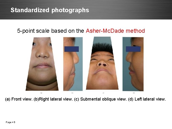 Standardized photographs 5 -point scale based on the Asher-Mc. Dade method (a) Front view.