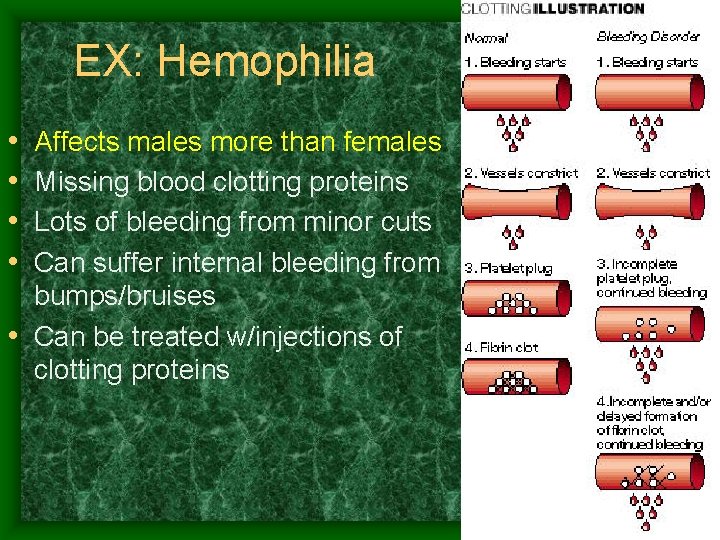 EX: Hemophilia • • Affects males more than females Missing blood clotting proteins Lots