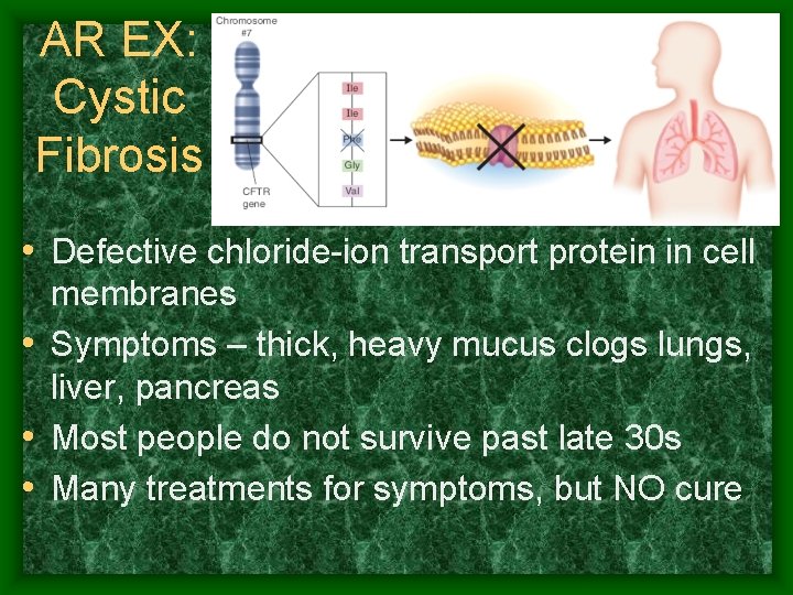 AR EX: Cystic Fibrosis • Defective chloride-ion transport protein in cell membranes • Symptoms