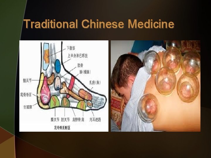 Traditional Chinese Medicine 