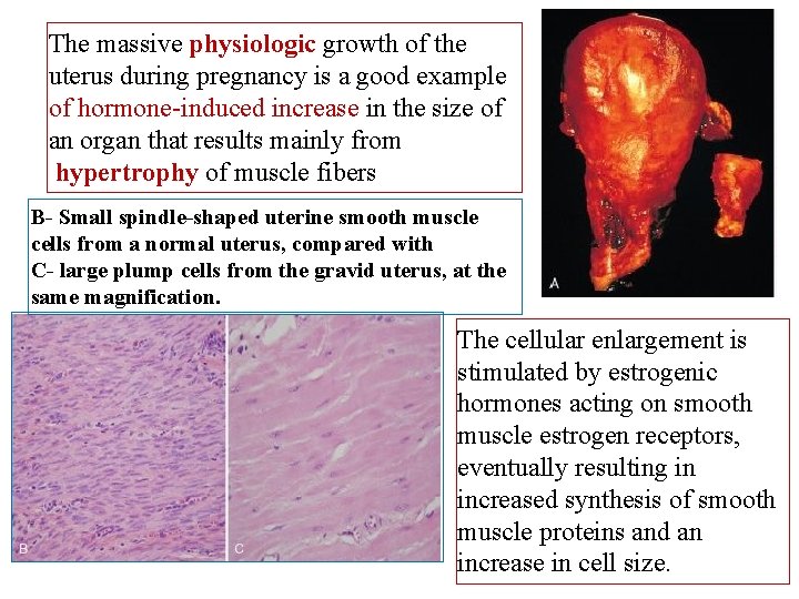 The massive physiologic growth of the uterus during pregnancy is a good example of